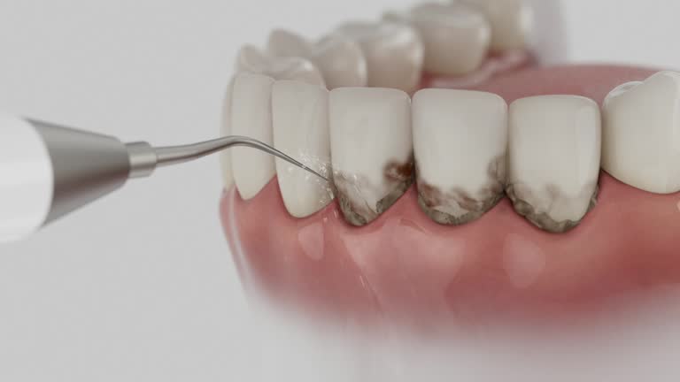 Trusted Teeth Whitening service in Benton Heights, MI - Dentist Open Now
